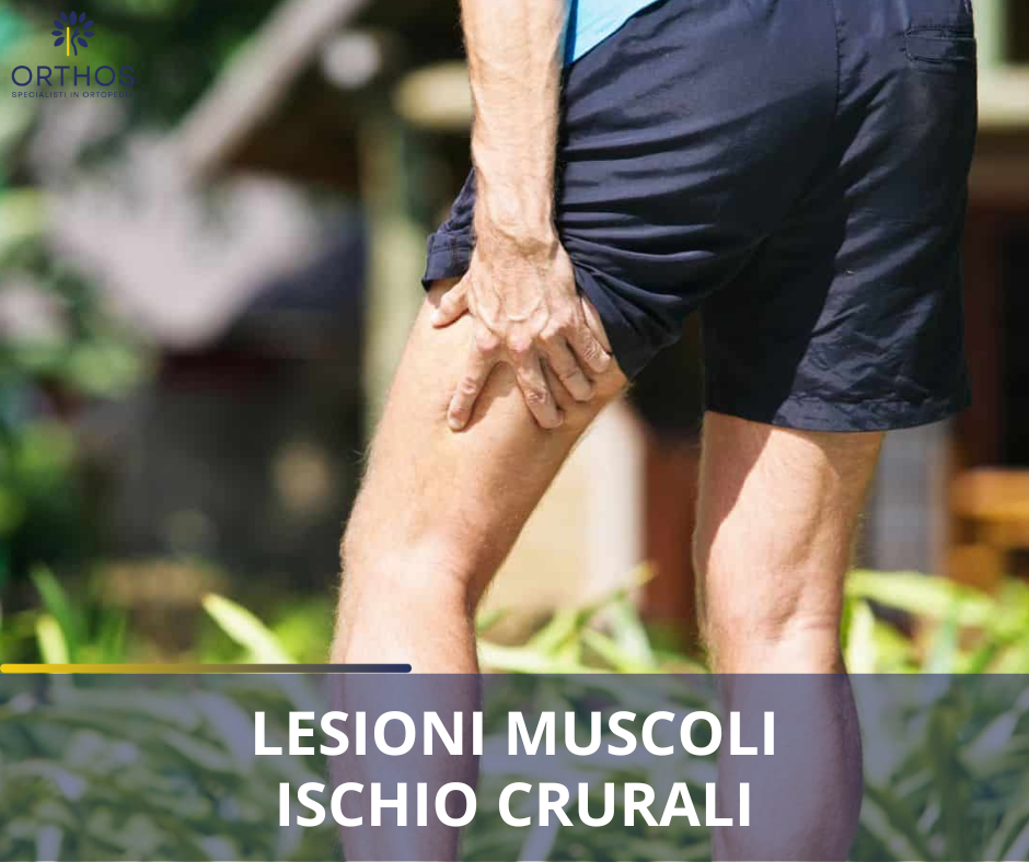 Lesioni muscoli ischio crurali Lesioni muscoli ischio crurali
